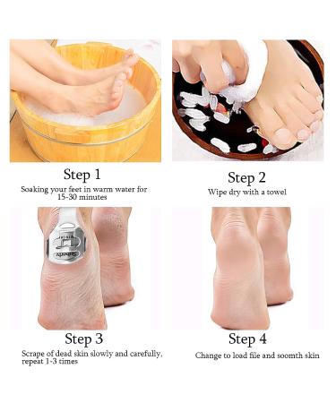 52 Pcs Callus Shaver Set - Stainless Steel Foot Razor with 50 Blades | Foot Care Tools for Hard Dry Skin Removal | Hand & Feet Callus Remover - Buy Online on SooperMarket.com