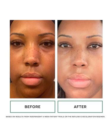 Replenix Redness Reducing Triple AOX Cream | Hydrating Antioxidant Treatment for Sensitive Skin | 1 fl. oz - Buy Online on SooperMarket.com