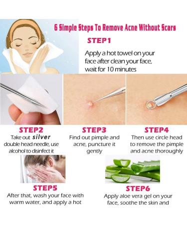 Ellolife 5-Pack Blackhead Remover Set - Stainless Steel Comedone Squeezer Kit for All Skin Types | Acne and Whitehead Extraction - Buy Online on SooperMarket.com