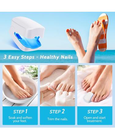 Incley Nail Fungus Cleaning Laser Device - Effective Blue Light Therapy for Toenails & Onychomycosis - Rechargeable Fungus Remover for Home Use - Buy Online on SooperMarket.com