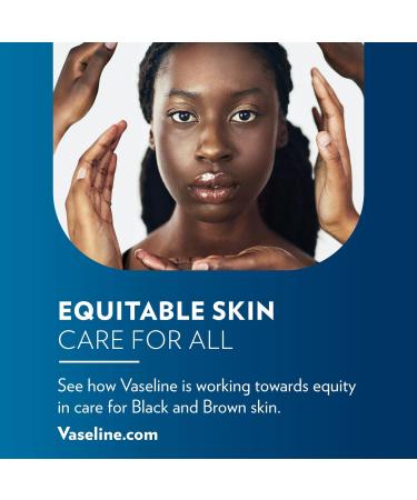 Buy 12 x Vaseline Lip Therapy Tin 20g Original - Moisturizing Lip Care - International Shipping Available - Buy Online on SooperMarket.com