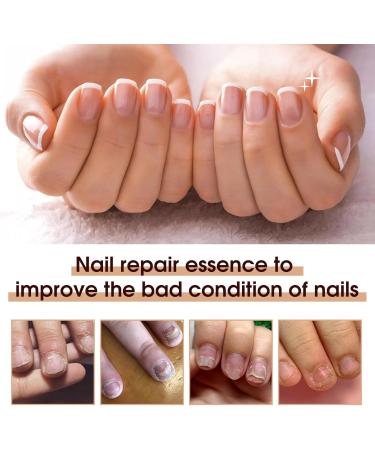 Organic Cuticle Nail Oil 30ml Vitamin B & E Essential Oil Moisturize with Convinient Dropper Design Nail Cuticles Oils Treatment Damaged Dry for Nail Care Repair Growth (Herbal) - Buy Online on SooperMarket.com