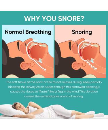 Anti-Snoring Mouth Guard - Comfortable & Adjustable Snore Device for Men/Women - Buy Online on SooperMarket.com