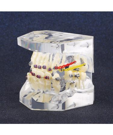 Dental orthodontic treatment model with painting PVC frame and resin teeth transparent gingiva small size orthodontist lessons in oral hygiene