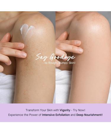 Vigority KP Bump Eraser - Exfoliating Cream for Keratosis Pilaris & Dry Skin Relief | International Shipping Available - Buy Online on SooperMarket.com