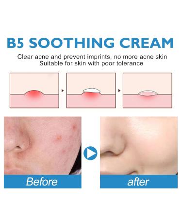 B5 Soothing Repairing Cream - Strengthen Skin Barrier Repair Acne-Prone Skin Improve Roughness | 40ml - International Shipping Available - Buy Online on SooperMarket.com
