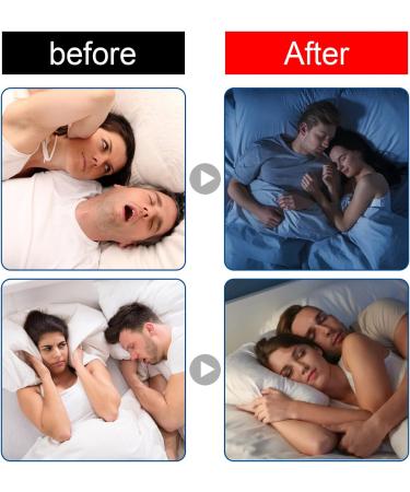 Mouth Tape for Sleeping - 120 PCS Medical-Grade Sleep-Closing Stickers for Nasal Breathing, Snoring, Dry Mouth - Orthodontic Aid - Buy Online on SooperMarket.com
