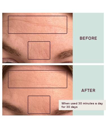 Buy Dermaclara Silicone Face Patches for Wrinkles & Fine Lines | Reusable Anti-Wrinkle Forehead & Under Eye Patches - Pregnancy Safe Skincare - Buy Online on SooperMarket.com