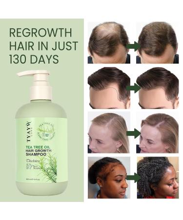 Rosemary Hair Growth Shampoo 3-in-1 | Tea Tree Mint Biotin Thickening Shampoo for Men & Women | 300ml for Hair Regrowth & Thinning Hair - Buy Online on SooperMarket.com
