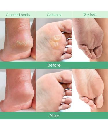 Plantifique Foot Peeling Mask - Combo 4 Pack for Soft & Smooth Feet - Buy Online on SooperMarket.com