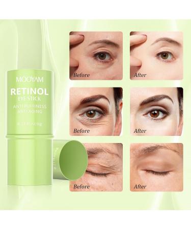 Retinol Eye Cream - Brightening Anti-Aging Eye Stick for Dark Circles & Puffiness | Under Eye Treatment for Men & Women - Buy Online on SooperMarket.com