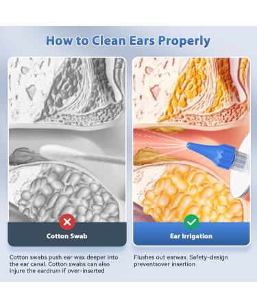 Qimic Ear Wax Removal Kit - Safe & Effective Ear Irrigation Flushing | Complete Cleaning Kit with 10 Replaceable Tips for Home Use - Buy Online on SooperMarket.com