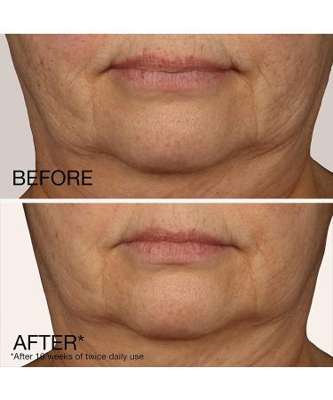 Neutrogena Peptide Contour Lift Cream 1.7 oz - Anti-Aging Facial Moisturizer - Buy Online on SooperMarket.com