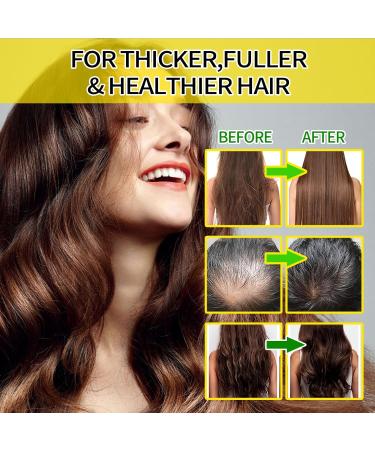 Batana Natural Hair Growth Oil - Organic Batana Oil for Stimulating Hair Growth Preventing Hair Loss & Eliminating Split Ends - 4FL OZ - Buy Online on SooperMarket.com
