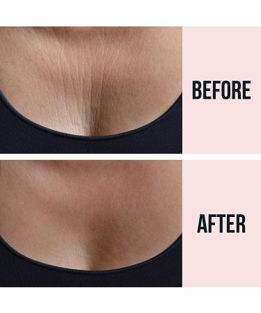 SiO Beauty SkinPad | Chest Anti-Wrinkle Pad 4 Weeks Supply | Overnight Silicone Pad for Cleavage & Decollete Skin - Beige - Buy Online on SooperMarket.com