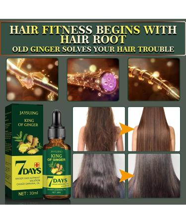 VigCebit 30ml Hair Growth Essence - Ginger Oil for Quick Dense Hair Growth & Nourishment | Anti-Hair Loss Solution - Buy Online on SooperMarket.com