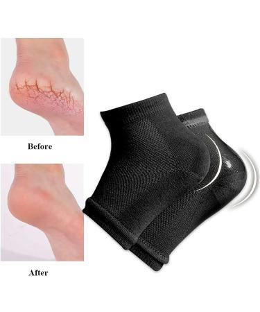 Aokbean Heel Socks - 2 Pairs Moisturizing Gel Socks for Dry Cracked Skin | Open Tip Silicone Foot Care for Men & Women (Black + Gray) - Buy Online on SooperMarket.com