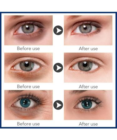 MIELIKKI Under Eye Cream - Dark Circles Fine Lines & Anti-Wrinkle Repair | Lifting & Firming Eye Care for Youthful Skin - Buy Online on SooperMarket.com