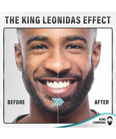 King Leonidas Beard Derma Roller 0.30mm Titanium Micro-Needling for Men - Facial Hair & Beard Growth - Buy Online on SooperMarket.com