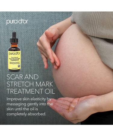 PURA DOR Organic Scar & Stretch Mark Treatment Oil | 1oz For Skin - Rosehip, Wheat Germ, Argan, Tamanu, Carrot, Rosemary, Lavender, Geranium, Patchouli, Sage - Buy Online on SooperMarket.com