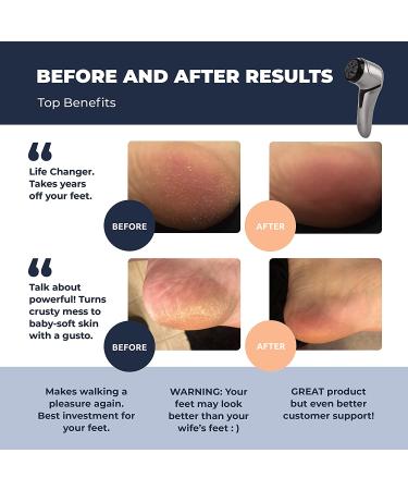 Own Harmony Electric Foot Callus Remover with Vacuum - Professional Pedicure Tools Kit for Powerful Pedi Care - CR2100 Quantum Silver - Buy Online on SooperMarket.com
