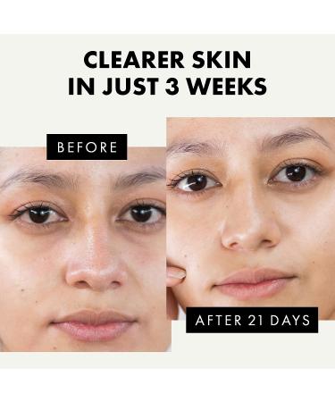 Tea Tree & Aloe Vera Gentle Face Cleanser for Normal to Oily Skin - Deep Cleansing & Hydrating Formula - Buy Online on SooperMarket.com