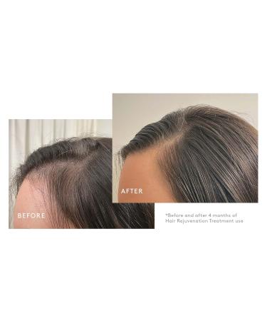 Virtue Flourish 100% Drug-Free Hair Growth Regimen - 3 Month Kit for Healthy Hair | International Shipping Available - Buy Online on SooperMarket.com
