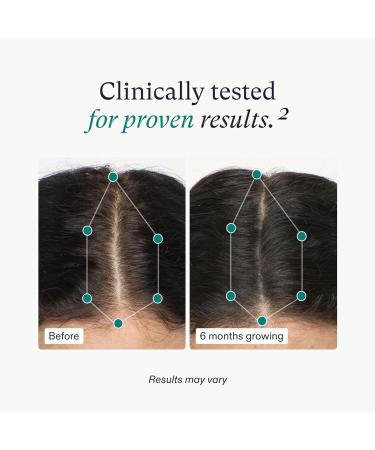 Nutrafol Women's Hair Growth Supplements - Clinically Proven Stronger Hair in 3-6 Months Dermatologist Recommended - 2 Month Supply & 2 Refill Pouches - Buy Online on SooperMarket.com