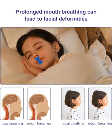 Mouth Tape for Sleeping - 60 Strips | Snoring Aid for Nasal Breathing | Anti-Snoring Myotape for Improved Sleep Quality - Blue - Buy Online on SooperMarket.com