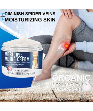 Varicose Veins Cream - Natural Treatment for Legs, Improve Blood Circulation, Strengthen Capillaries & Relieve Tired Legs - Buy Online on SooperMarket.com