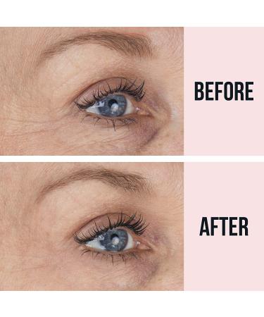 SiO Beauty Eye & Smile Lift | Anti-Wrinkle Patches 2 Week Supply | Overnight Smoothing Silicone Patches for Wrinkles and Fine Lines - Buy Online on SooperMarket.com