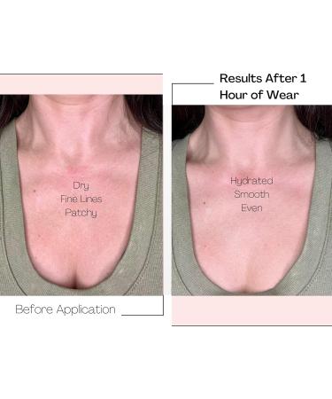 Wonderstripes Wrinkle Patches - Reusable Silicone Chest Pads for Side Sleepers | Anti-Wrinkle Solution for Decollet | Ships Internationally - Buy Online on SooperMarket.com