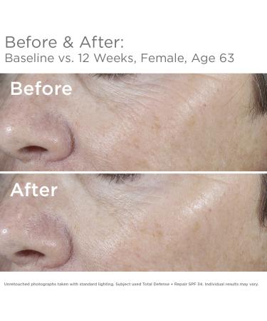 SkinMedica Total Defense + Repair SPF 34 Sunscreen 2.3 oz - Broad Spectrum Protection - Buy Online on SooperMarket.com