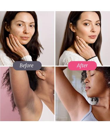 Divine Derriere Intimate Dark Spot Remover - Mulberry Extract, Alpha Arbutin, Peptide Corrector Cream for Body, Face, Bikini & Sensitive Areas - Buy Online on SooperMarket.com