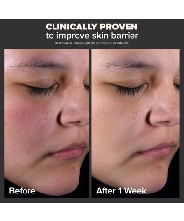 Paula's Choice Skin Perfecting 2% BHA Liquid Salicylic Acid Exfoliant Duo Gentle Exfoliator for Blackheads Large Pores Wrinkles & Fine Lines Includes 1 Full Size Bottle & 1 Travel Size Bottle Full Size + Travel Size Duo - Buy Online on SooperMarket.com