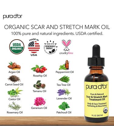 PURA DOR Organic Scar & Stretch Mark Treatment Oil | 1oz For Skin - Rosehip, Wheat Germ, Argan, Tamanu, Carrot, Rosemary, Lavender, Geranium, Patchouli, Sage - Buy Online on SooperMarket.com