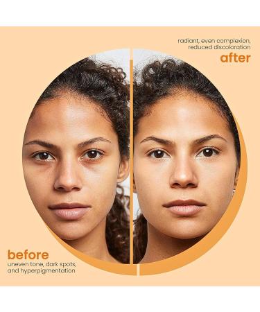 Kojic Acid & Turmeric Face Wash Foaming Cleanser Turmeric Facial Cleanser Gentle Foaming Face Wash for Oily Skin Acne Prone Skin Turmeric Mousse Cleanser for Dark Spots Removes Excess Oil - Buy Online on SooperMarket.com