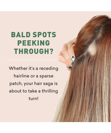 Bald Spot Hair Growth Cream | Scalp Treatment for Receding Hair | Just Nutritive | 4 Oz | Unisex Hair Restoration - Buy Online on SooperMarket.com