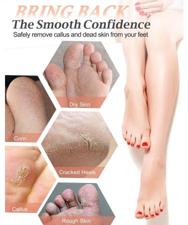 Maryton Natural Pumice Stone for Feet - Exfoliating Scrubber for Dead Skin, Corns, and Calluses - Pedicure Tool for Soft, Smooth Feet and Hands - Buy Online on SooperMarket.com