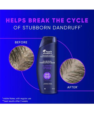 Head & Shoulders Clinical Oil Control Shampoo for Stubborn Dandruff 400 mL Strength Dandruff Defense + Advanced Oil Control - Buy Online on SooperMarket.com