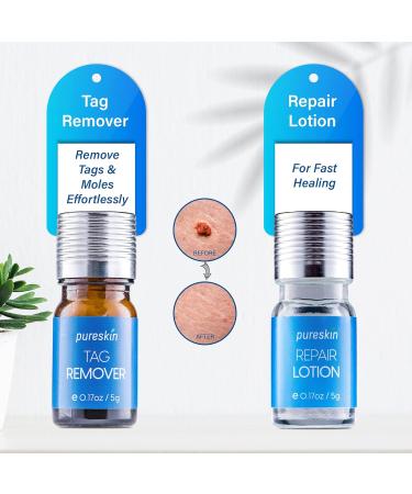 Pureskin Skin Tag Remover & Mole Corrector And Repair Lotion Set Remove Tags and Moles Effortlessly - Buy Online on SooperMarket.com