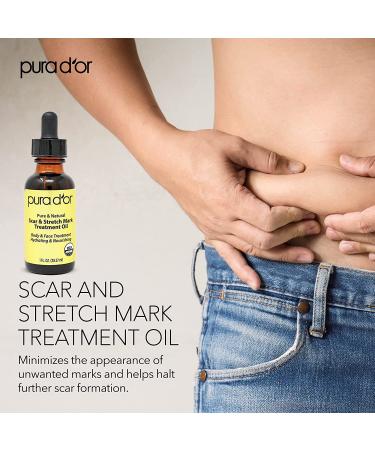 PURA DOR Organic Scar & Stretch Mark Treatment Oil | 1oz For Skin - Rosehip, Wheat Germ, Argan, Tamanu, Carrot, Rosemary, Lavender, Geranium, Patchouli, Sage - Buy Online on SooperMarket.com