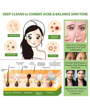 LILY SADO MATCHA MADE IN HEAVEN Sugar Facial Scrub - Daily Exfoliating Cleanser for All Skin Types - Vegan, Acne Treatment, Pore Reducing - 4 oz - Buy Online on SooperMarket.com