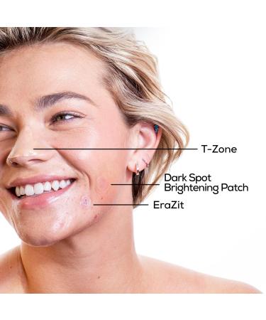 HANHOO Blemish Patch Discovery Kit | 7-Piece Hydrocolloid Variety Set for Pimples Dark Spots & Clogged Pores | International Shipping Available - Buy Online on SooperMarket.com