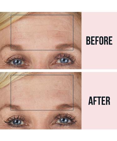 SiO Beauty BrowLift Anti-Wrinkle Forehead Patch - Reusable Silicone for Furrows & Expression Lines (Beige) - Buy Online on SooperMarket.com