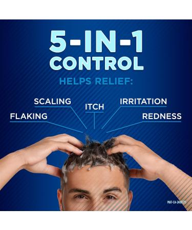 Selsun Blue Normal-Oily Hair Anti-Dandruff Shampoo 300mL Helps Control Dandruff Itching and Flaking 1% Selenium Sulfide Formula - Buy Online on SooperMarket.com