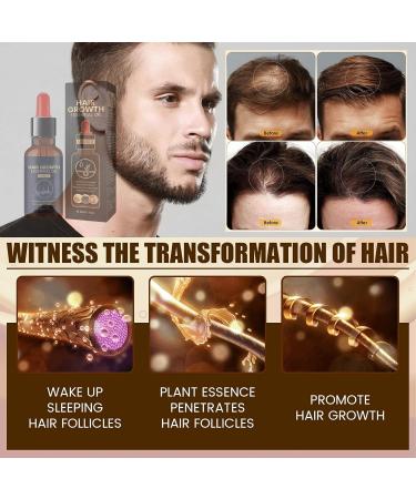Trendyfave Hair Growth Serum Hair Serum for Hair Growth Ginger Hair Growth Serum Anti Hair Loss Essence for Fast Hair Growth Nourishing Repair Damaged Hair Stimulates Hair Growth Serum for Women Men - Buy Online on SooperMarket.com