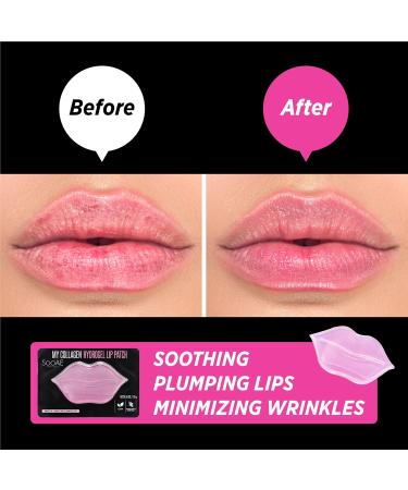SooAE My Collagen Hydrogel Lip Patch - 12 Count Moisturizing Anti-Aging Lip Mask for Youthful Lips - Buy Online on SooperMarket.com