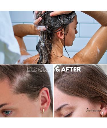 Just Nutritive Hair Loss Shampoo 16 Oz - Hair Regrowth Treatment For Thinning Hair - Men and Women Hair Growth Product - Buy Online on SooperMarket.com