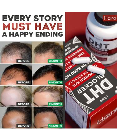 DHT Blocker Hair Growth Supplement with Biotin & Saw Palmetto - Natural Hair Loss Treatment for Women & Men - Buy Online on SooperMarket.com